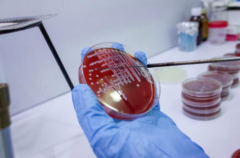 Bacterial,Growth,On,Culture,Agar,Plate